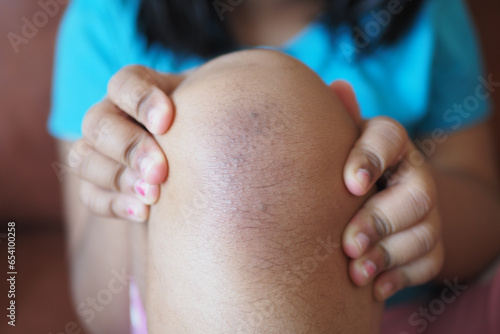  child girl suffering from itching skin, close up.