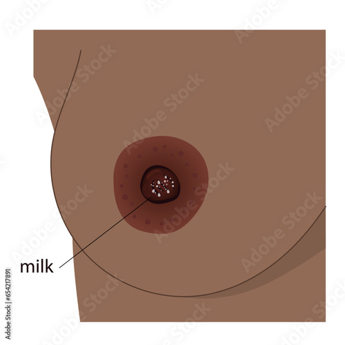 Woman leaking breast realistic image. Part of breast of dark skin female with nipple and drops of milk, areola and Montgomery's glands represented.