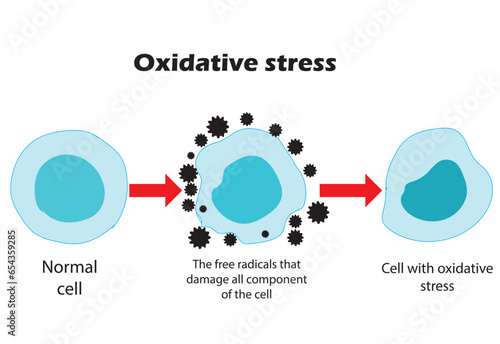 Oxidative stress. From normal cells, to oxidative stress and aggressive free radicals, to cell death. Vector illustration.