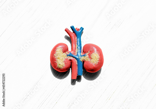 Human Kidneys Model with Sand Particles photo