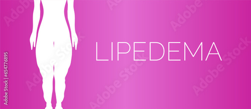 Lipedema Pink Medical Background Illustration with Woman Legs