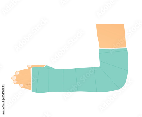 broken arm with plaster- vector illustration