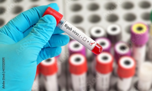 Nipah virus concept.Womans hand holding a glass test tube.Nipah Henipavirus is a newly emerging bat-borne virus that causes acute respiratory illness.Closeup.