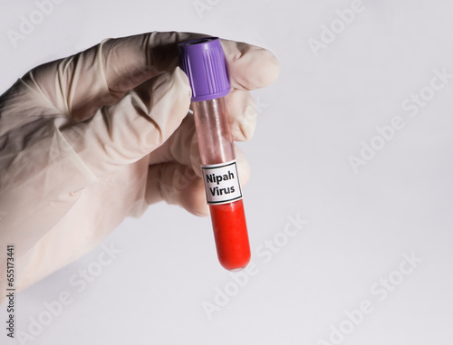 The picture shows a test tube with blood infected by the Nipah virus that is held in the hand of a qualified doctor.