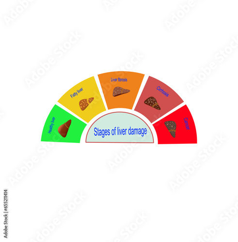 Stages of live damage infographic concept, vector illustration