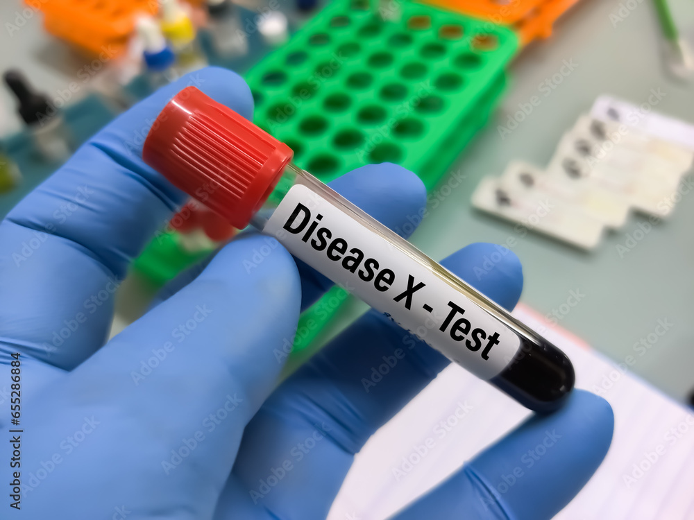 Obraz premium Blood sample for Disease X test. Disease X represents the knowledge that a serious international epidemic could be caused by a pathogen currently unknown to cause human disease