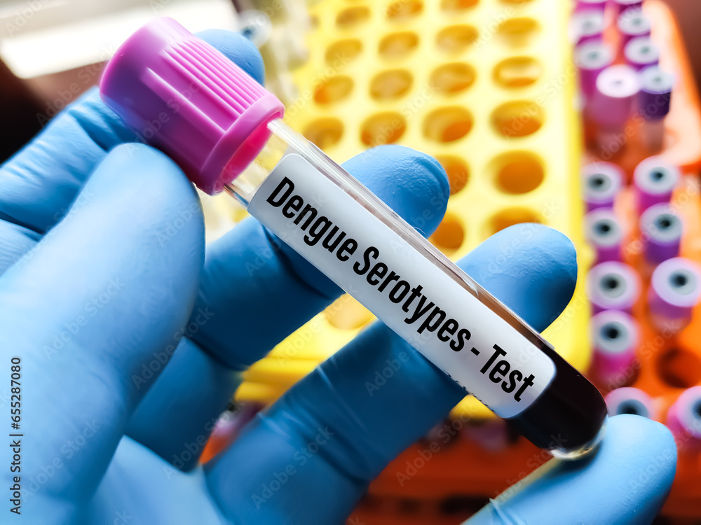 Blood sample for Dengue Serotypes (Denv 1, 2, 3 and 4) test. To