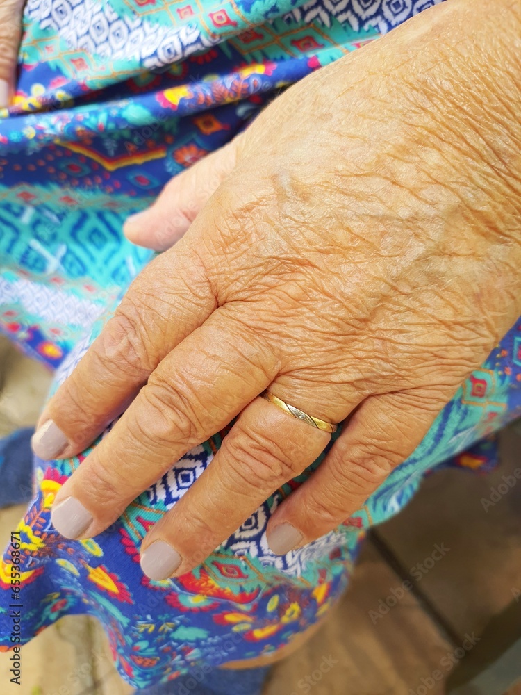 Close-up of an elderly woman's hand resting on her knee, wearing a colorful dress and her wedding ring.