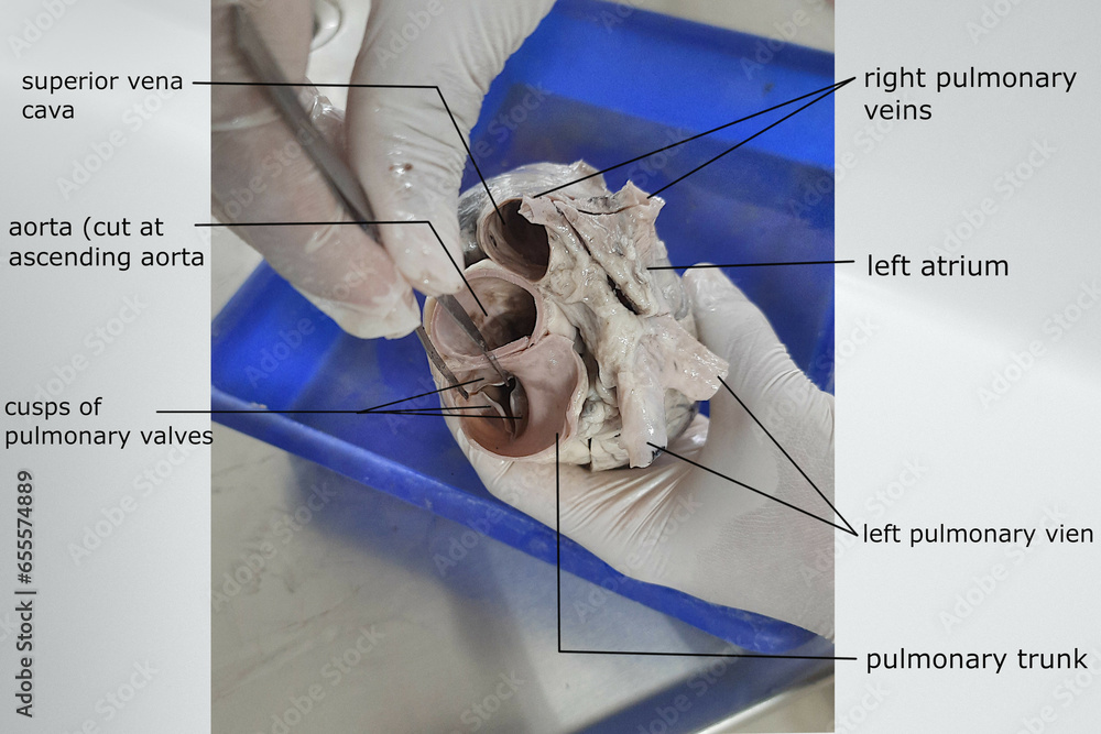 superior view of heart showing opening of aorta, superior vena cava ...