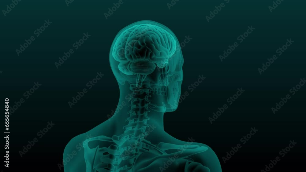 X-ray scan of the human head and neck with the skull and brain visible ...