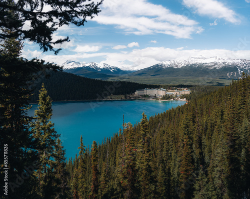 Fairview lookout of Fairmont Chateau in Lake Louise at Banff National Park in Alberta Canada. Mountain and adventure travel concept. photo