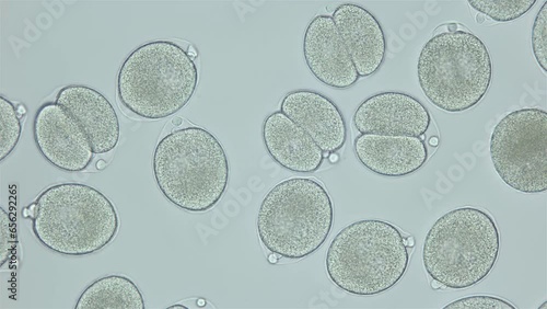 Fertilized egg of worm Ophelia limacina under microscope. Stage is one-celled and two-celled, polar bodies and germinal vesicle are visible. White Sea photo