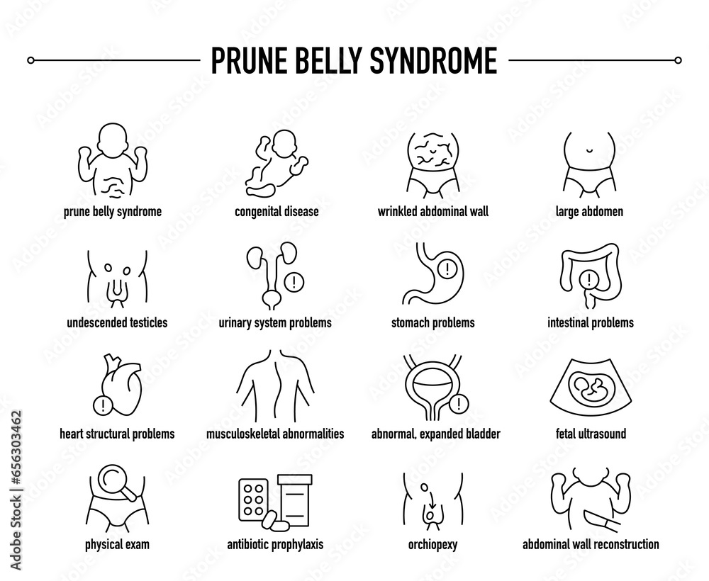 Prune Belly Syndrome symptoms, diagnostic and treatment vector icons. Line editable medical icons.