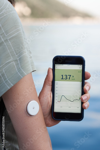 The women reads the glucose values from the Abbott Freestyle Libre sensor using an application on mobile phone. The latest technology for better life quality for a diabetic.