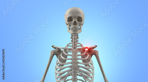 Human skeleton with broken clavicle