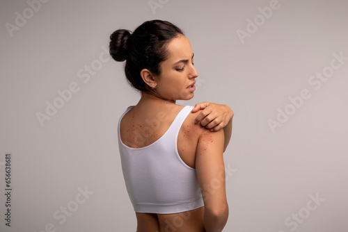 Konstfotografi Brunette young woman scratching red spots on her skin