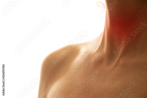 Female throat with a red spot in the middle of the neck on a light background, sore throat, sore throat, flu photo