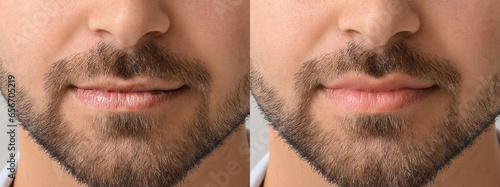 Young man before and after ...