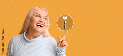 Canvastavla Smiling mature woman with implanted tooth on yellow background