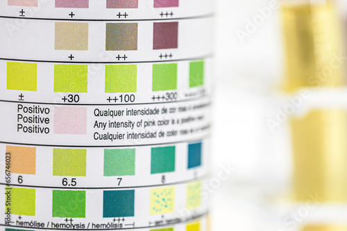 vial with test strips for urinalysis used to control ketosis and other 9 parameters, laboratory use by a healthcare professional photo