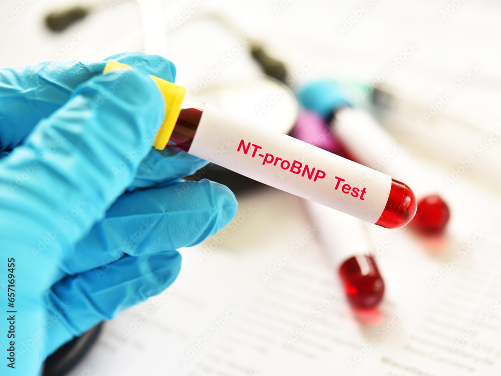 Blood sample tube for NTproBNP test, cardiac marker for acute or