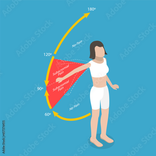 3D Isometric Flat Vector Conceptual Illustration of Painful Arc Test, Rotator Cuff Disorder