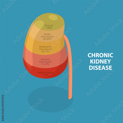 3D Isometric Flat Vector Conceptual Illustration of Chronic Kidney Disease, Urinary System Problems