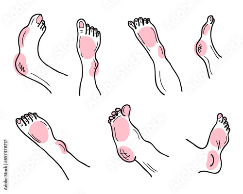 Hand drawn feet and legs body parts collection. Health care, cosmetic and therapy concept. Isolated vector illustration.
