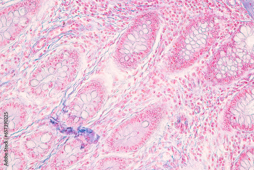 Histological Rectum human, Gall bladder human and Urethra Human under the microscope for education.