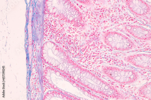Histological Rectum human  Gall bladder human and Urethra Human under the microscope for education.