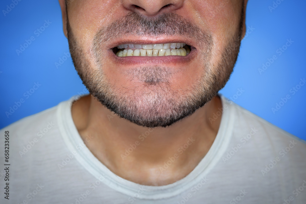 Obraz premium Close-up of a man's mouth, before teeth care.