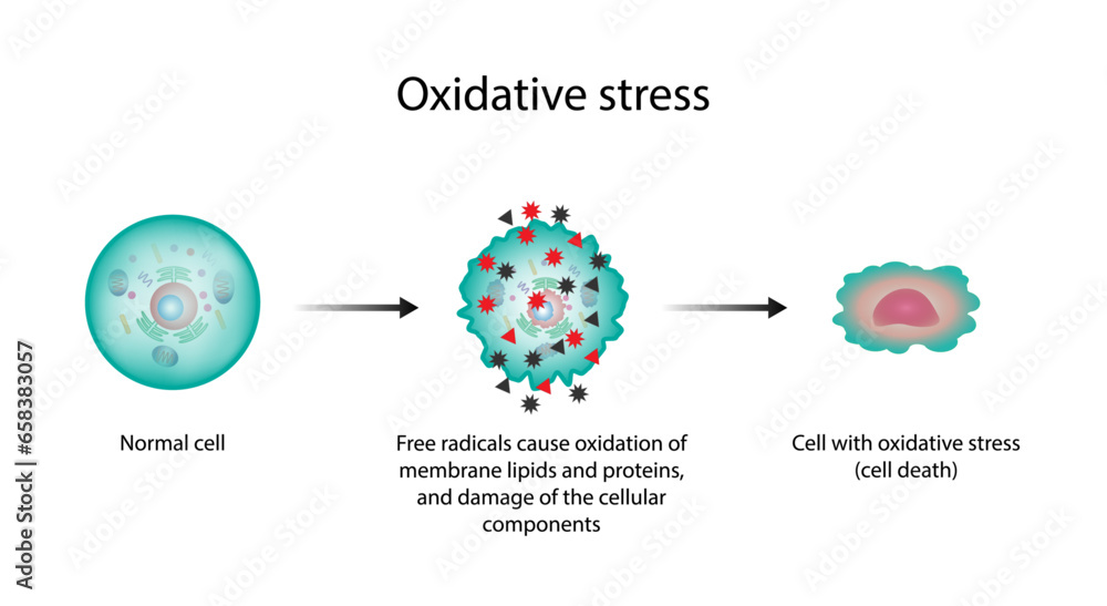 Oxidative stress. Free radicals cause oxidation of the cellular ...