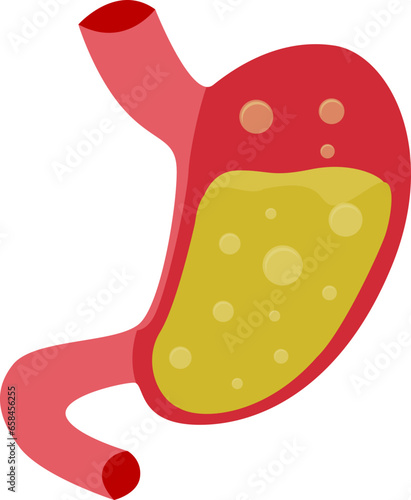 gastric acid substances HCL, hydrochloric acid