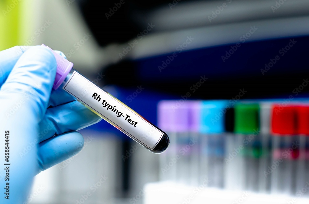 Blood sampling tube for Rh typing analysis. Blood sampling tube for Rh typing analysis.