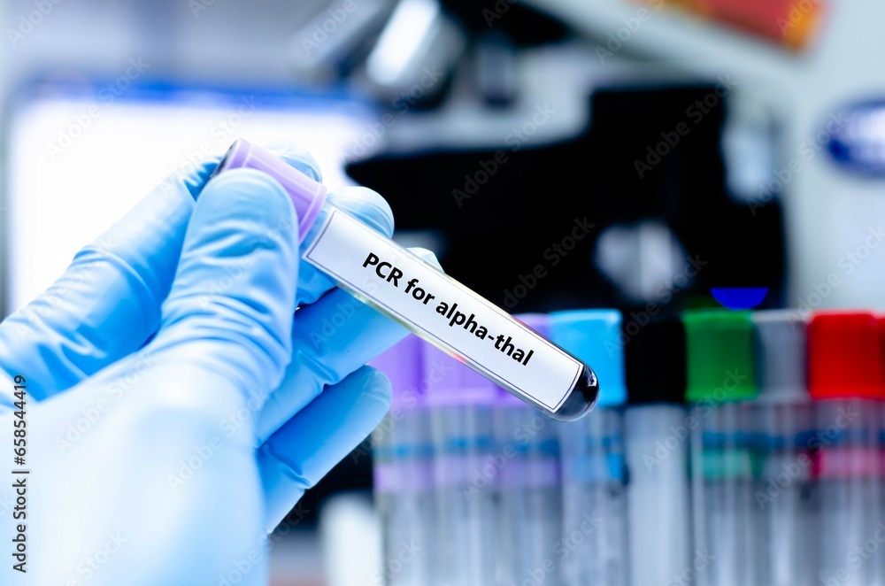 Blood sampling tube for PCR for alpha-thal analysis. Blood sampling tube for PCR for alpha-thal analysis.