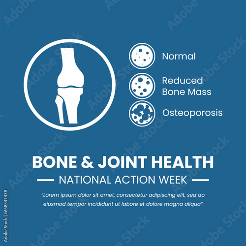 Illustration of Knee Anatomy and Bone Osteoporosis good for Bone and Joint Health National Action Week