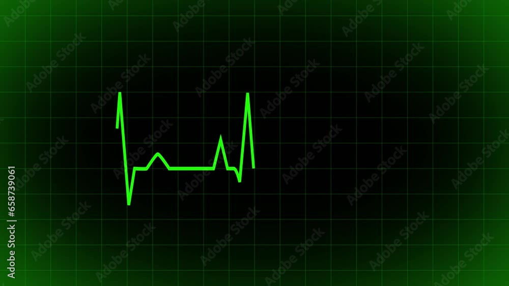 Normal ECG wave. Electrocardiogram show heart beat line animation. cardiogram, Heart pulse animation. Heartbeat pulse rate graph. Glowing neon pulse line. Normal ECG wave. Electrocardiogram show heart beat line animation. cardiogram, Heart pulse animation. Heartbeat pulse rate graph. Glowing neon pulse line.