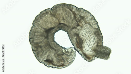 Parasitic worm Echinorhynchus gadi under microscope, phylum Acanthocephala. Eversible proboscis are visible with which they pierce intestines of their host. White sea photo