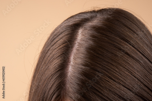 Woman hair loss problem, baldness of the head. Health care shampoo and beauty product concept.