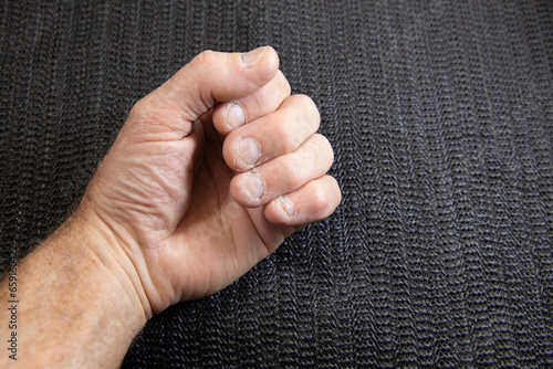 Hand bitten finger nails on black background