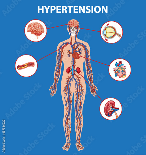 Science Education: Human Anatomy and Hypertension Effects