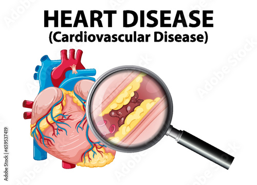 Sickness and Heart Disease in Medical Anatomy Infographic