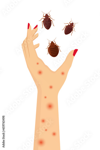 Vector of itchy hand caused by bed bug bite. Bed bug invasion