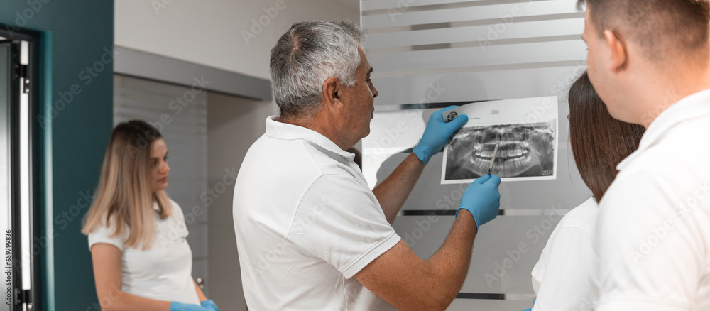 Obraz premium A team of dentists study X-ray scans, MRI scans of oral teeth, discuss treatment methods and the feasibility of using implants in a dental center