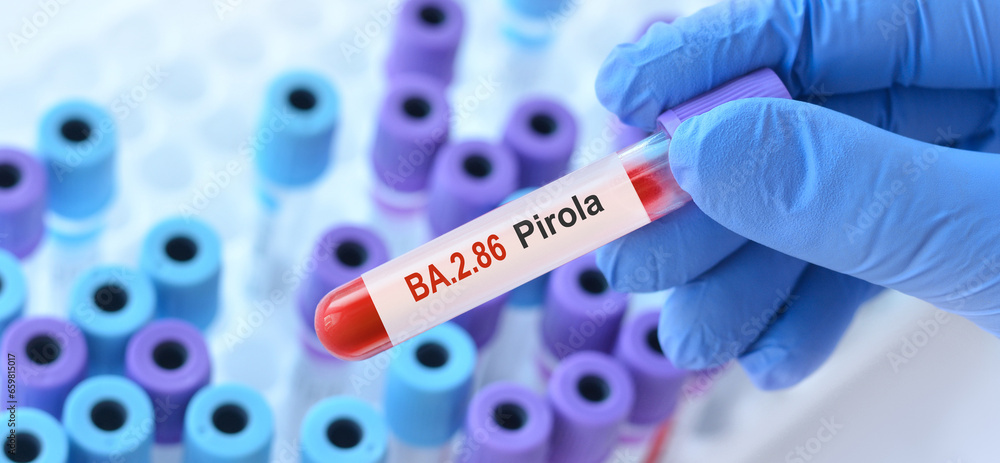 Obraz premium Doctor holding a test blood sample tube for the detection of the BA.2.86 Pirola on the background of medical test tubes.New Covid 19 Pirola Variant