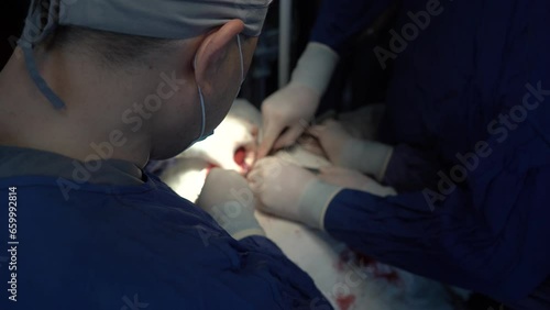 three doctors working together in thyroidectomy photo