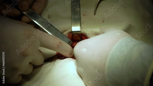 surgical resident holding the opening with the instrument