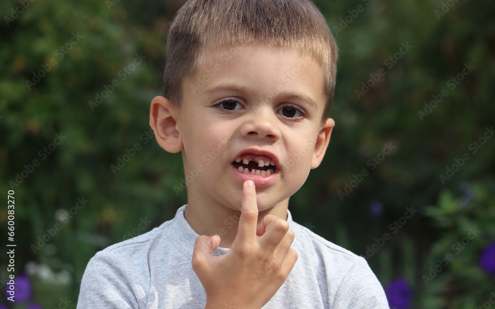a boy without a tooth. Selective focus. a boy without a tooth. Selective focus.