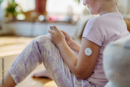 Diabetic girl with continuous glucose monitor on arm. The CGM device makes the life of schoolgirl easier, helping manage illness and focus on other activities. photo