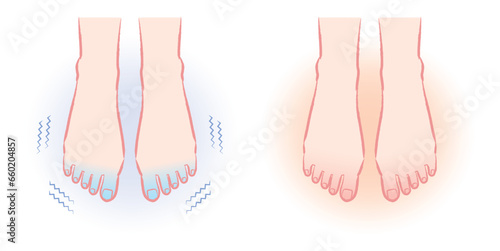 冷え性の足先　ぽかぽかの足先のイラスト　ビフォーアフター